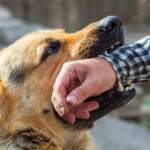 What A Dog Bite Attorney Actually Does For Injury Victims